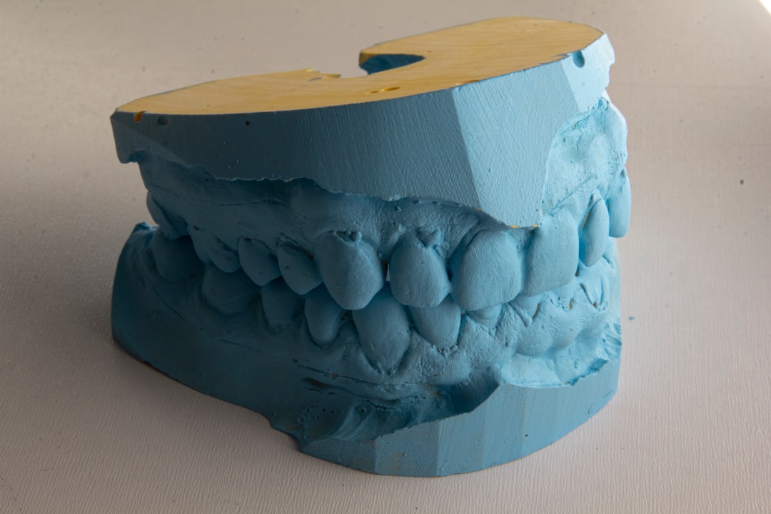 Dental bridge procedure