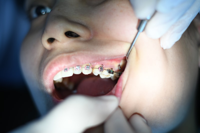 Dental crown procedure