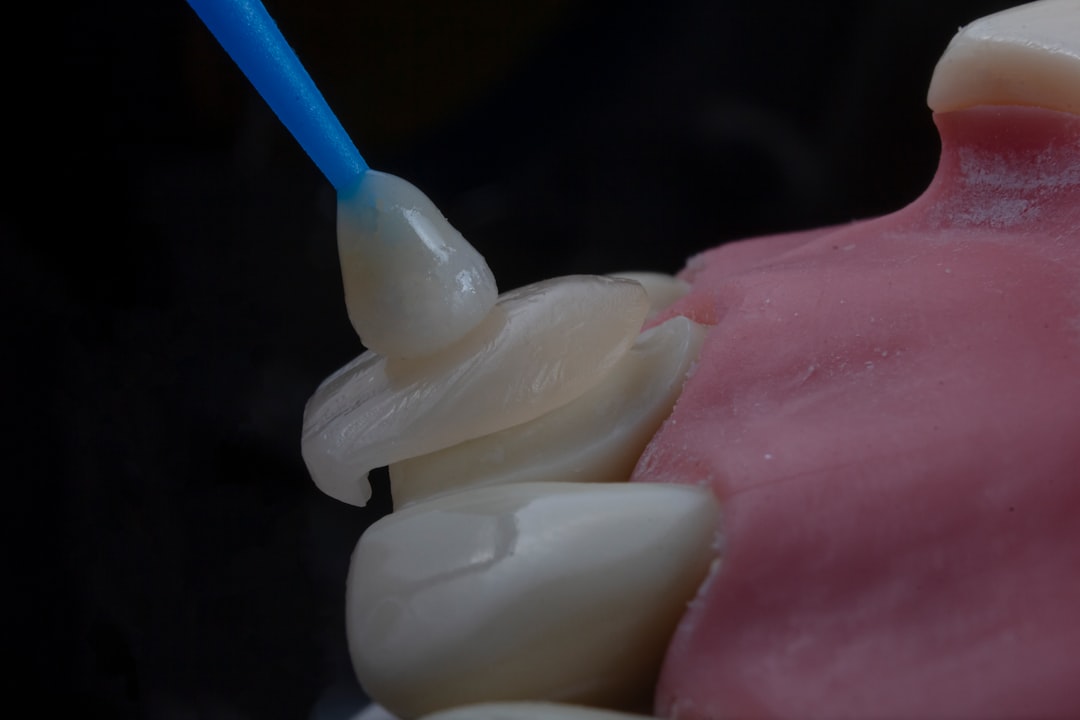 Dental filling procedure