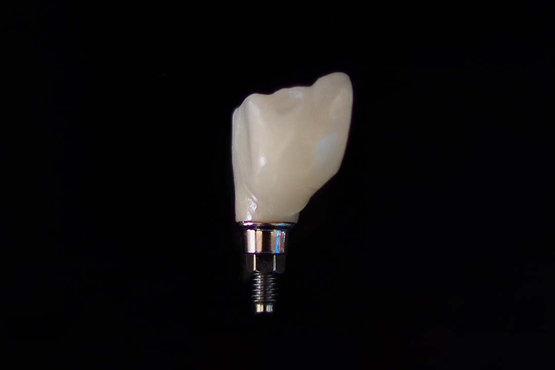 Dental implant procedure