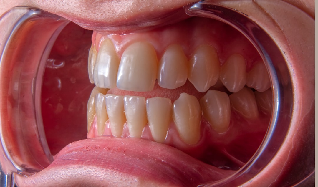 Periodontal gum treatment