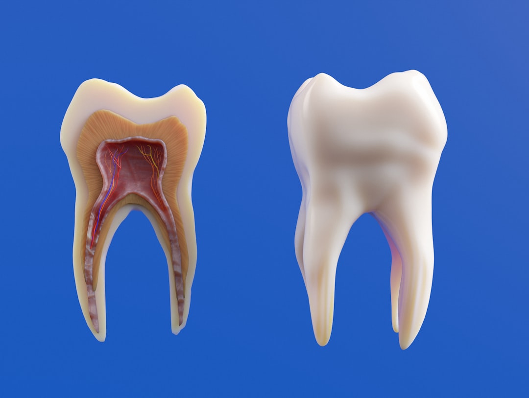 Root canal therapy procedure