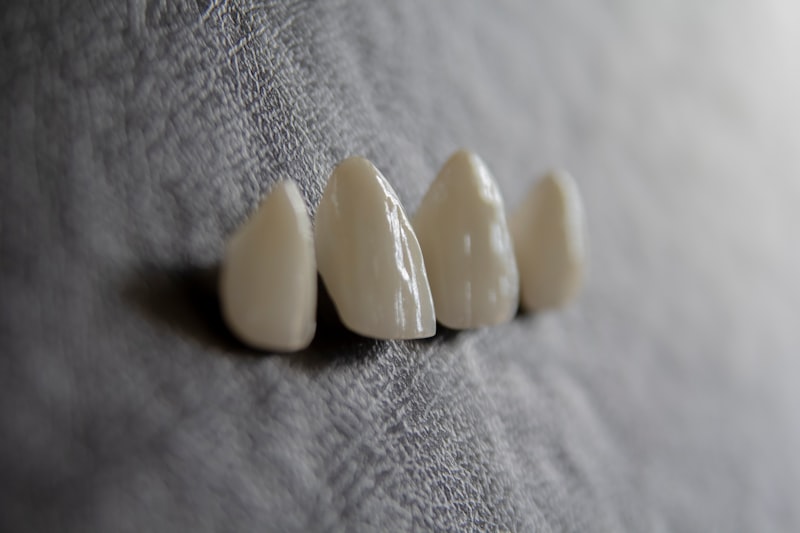 Teeth whitening procedure