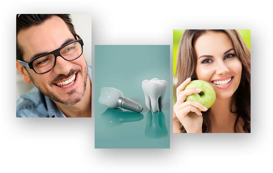 Dental Implants Miami